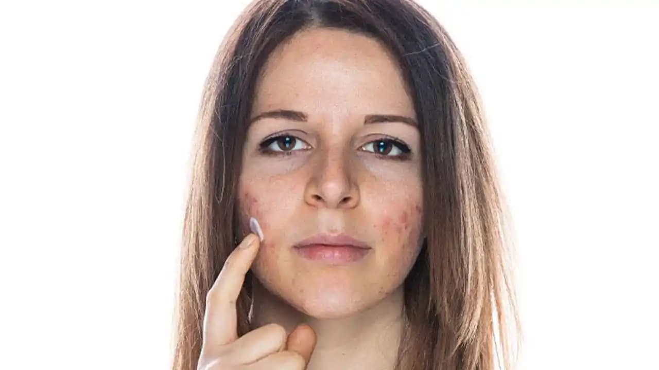 Yüzdeki Pürüzlere Karşı Etkili Bakım Yöntemleri ve Doğal Çözümler