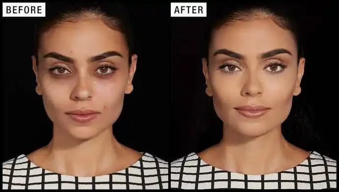 Yüzdeki Renk Eşitsizliği Nasıl Giderilir: Etkili Yöntemler ve Bakım İpuçları