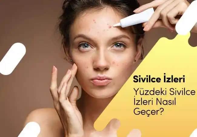 Yüzdeki Şiş Sivilcelerin Nedenleri ve Etkili Tedavi Yöntemleri