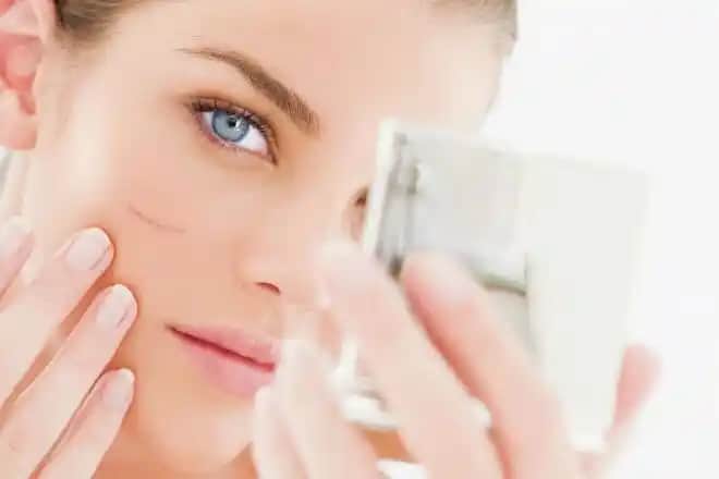 Yüzdeki Yara İzlerini Azaltmak İçin Doğal ve Medikal En Etkili Yöntemler