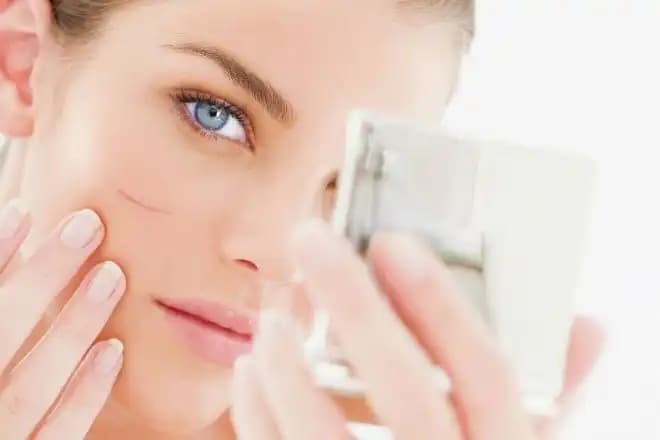 Yüzdeki Yara İzlerini Azaltmak İçin Doğal ve Medikal En Etkili Yöntemler