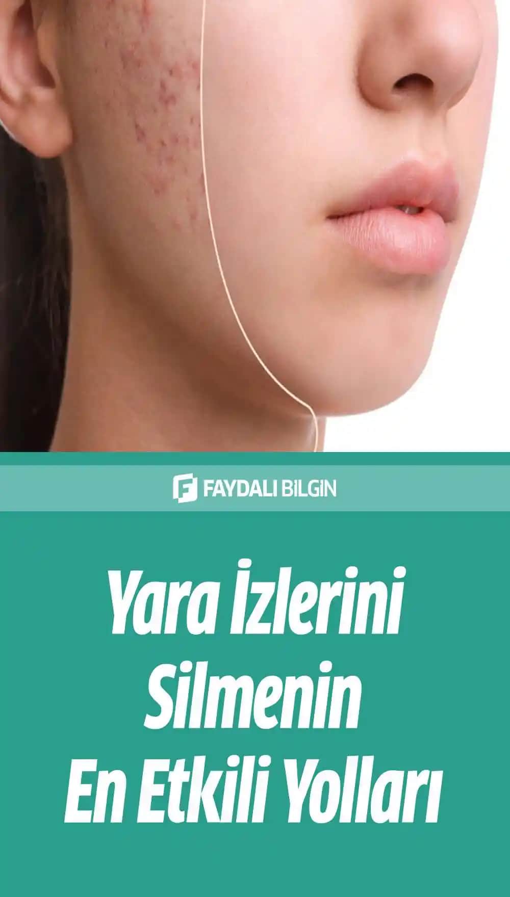 Yüzdeki Yaraların Hızlı Geçmesi İçin Etkili ve Güncel Yöntemler