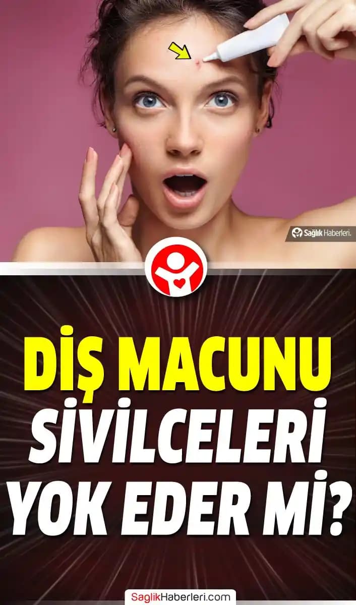 Yüze Diş Macunu Sürmek: Gerçekler ve Riskler Cilt Sağlığı Üzerine Bilmeniz Gerekenler