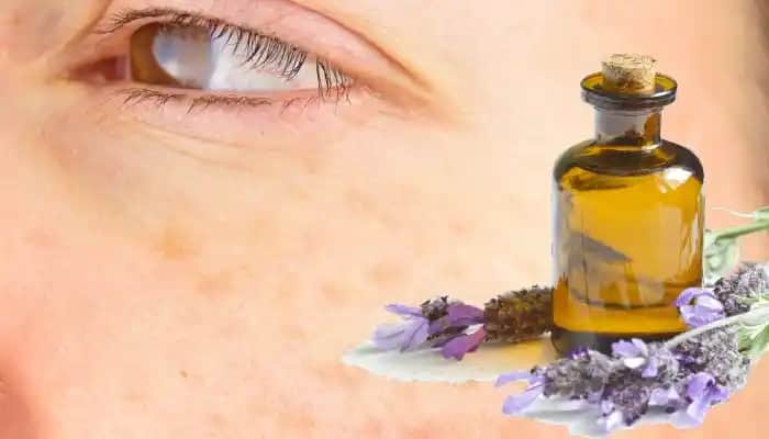 Yüze Lavanta Yağı Sürmek: Güvenlik ve Faydalar Hakkında Bilmeniz Gerekenler