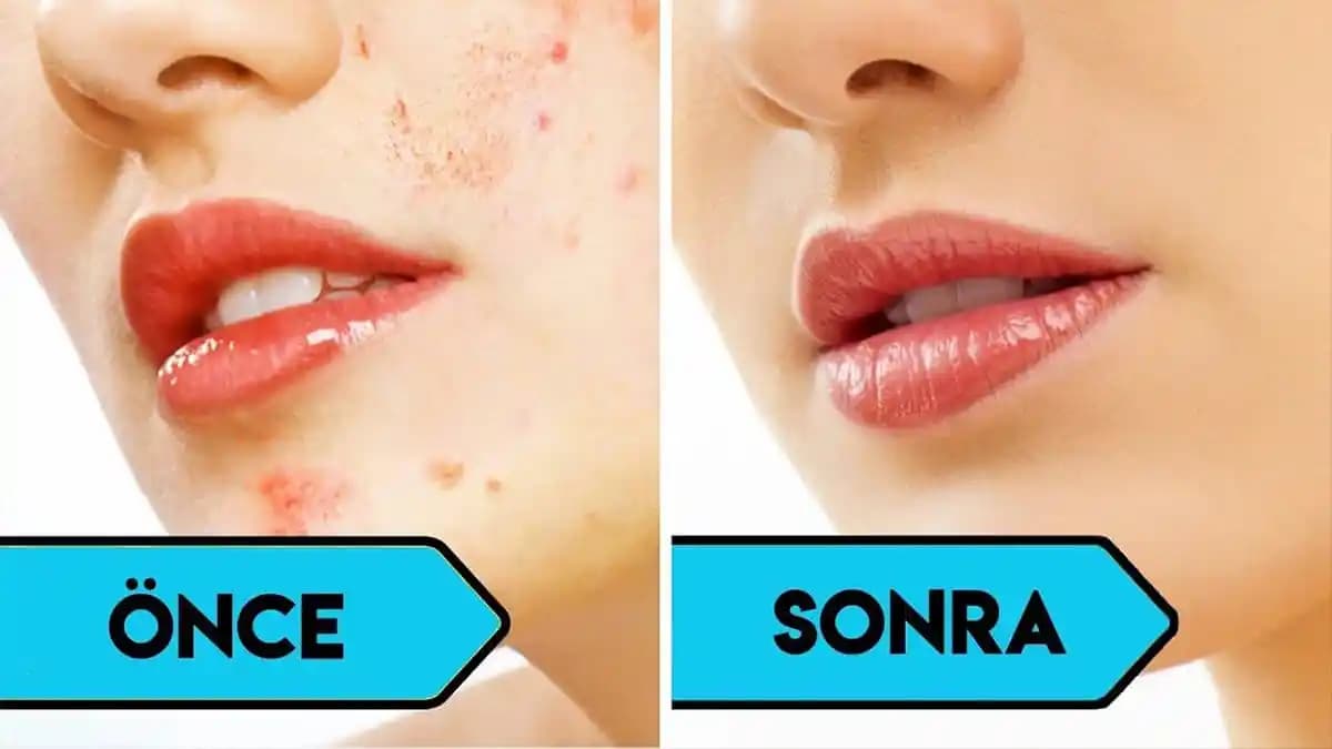 Yüzü Parlatan Kremler ve Doğru Kullanım Yöntemleri ile Sağlıklı ve Işıltılı Cilt