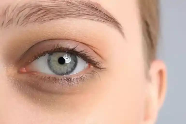 Çocuklarda Göz Altı Morluğu: Tıbbi Müdahale ve Teknolojik Çözümler Üzerine Analiz