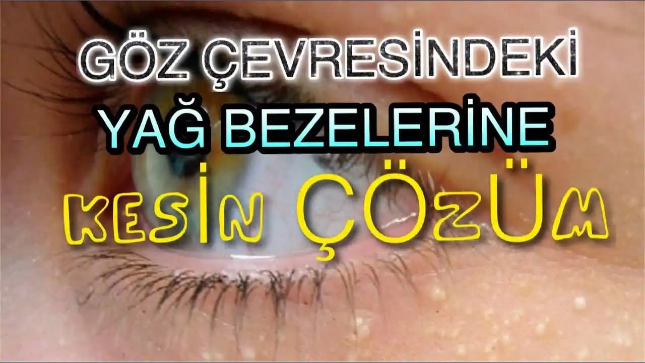 Göz İçinde Yağ Bezesi Nedir ve Nasıl Tedavi Edilir? Etkili Yöntemler ve Bakım Önerileri