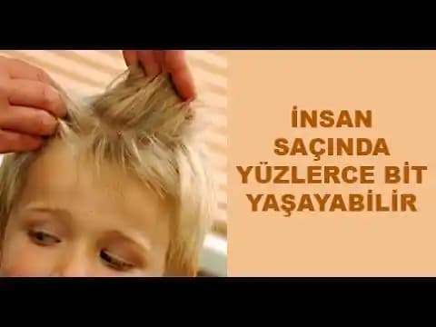 Saçta Bit Görüntüsü: Belirtileri, Önemi ve Genel Değerlendirme