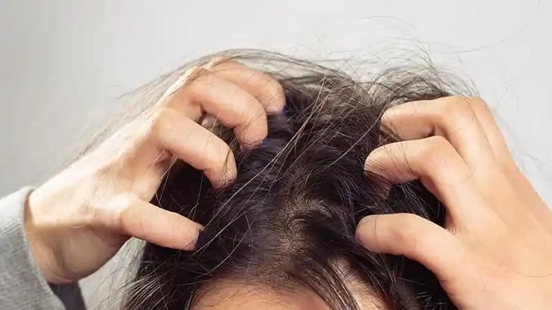 Saçta Kaşıntı Nedenleri ve Saç Derisi Sağlığını Destekleyen Etkili Faktörler