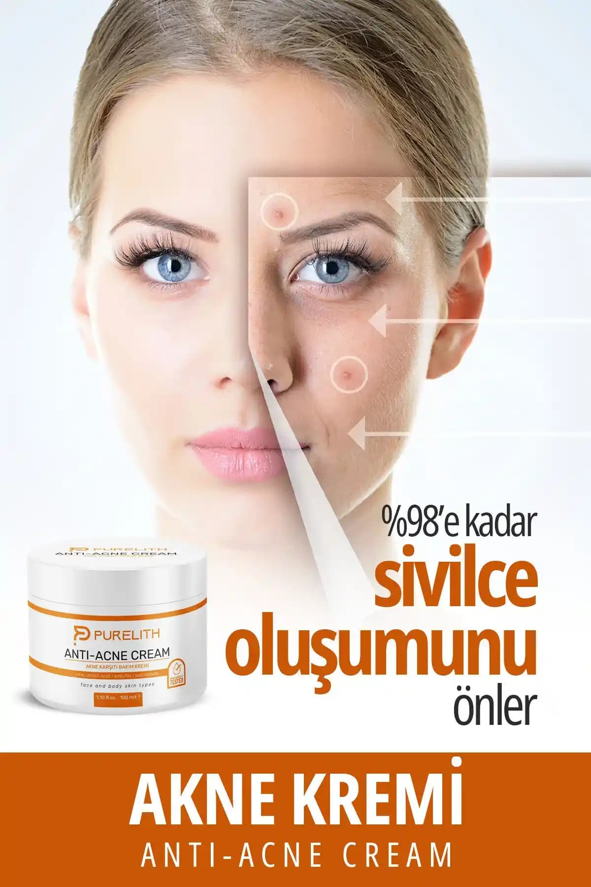 Sivilce Geçiren Krem Hakkında Güncel Bilgi ve Kullanımına Dair Kapsamlı Değerlendirme