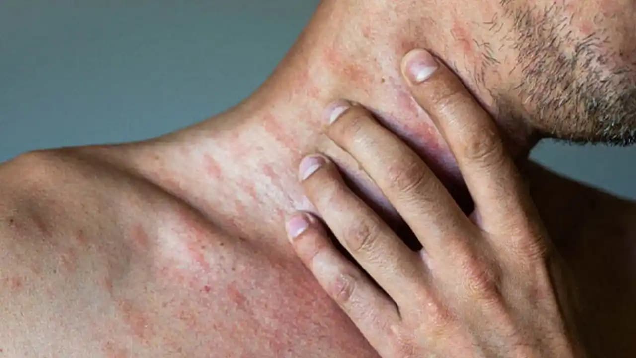 Yetişkinlerde Isilik: Mevcut Bilgi Durumu ve Tedavi Yöntemlerindeki Eksiklikler