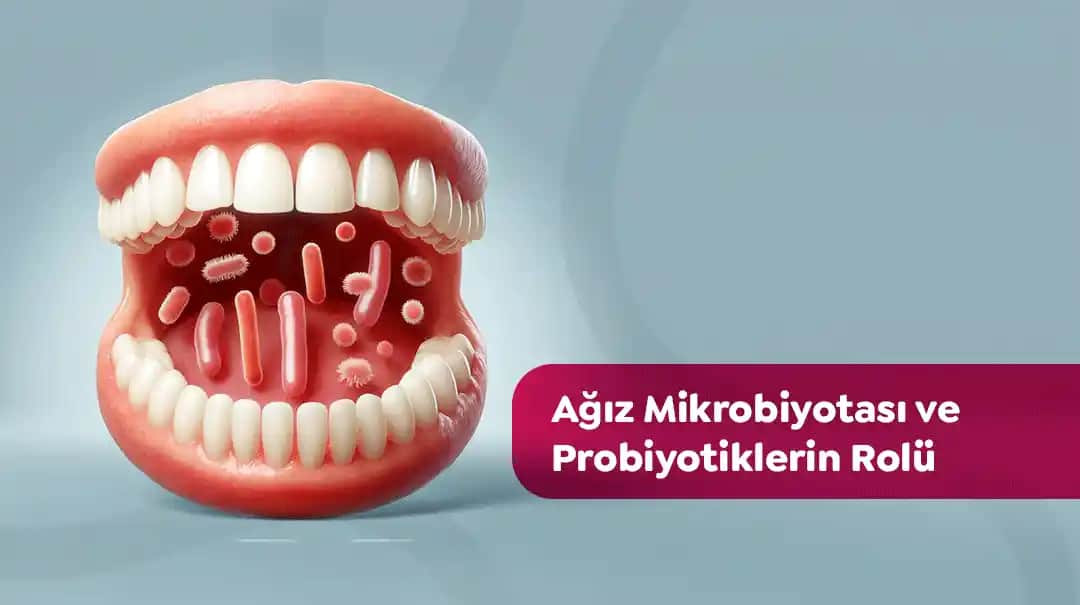 Ağız İçi Probiyotikler ile Sağlıklı Gülüş İçin Güncel Yaklaşımlar ve Kullanım İpuçları