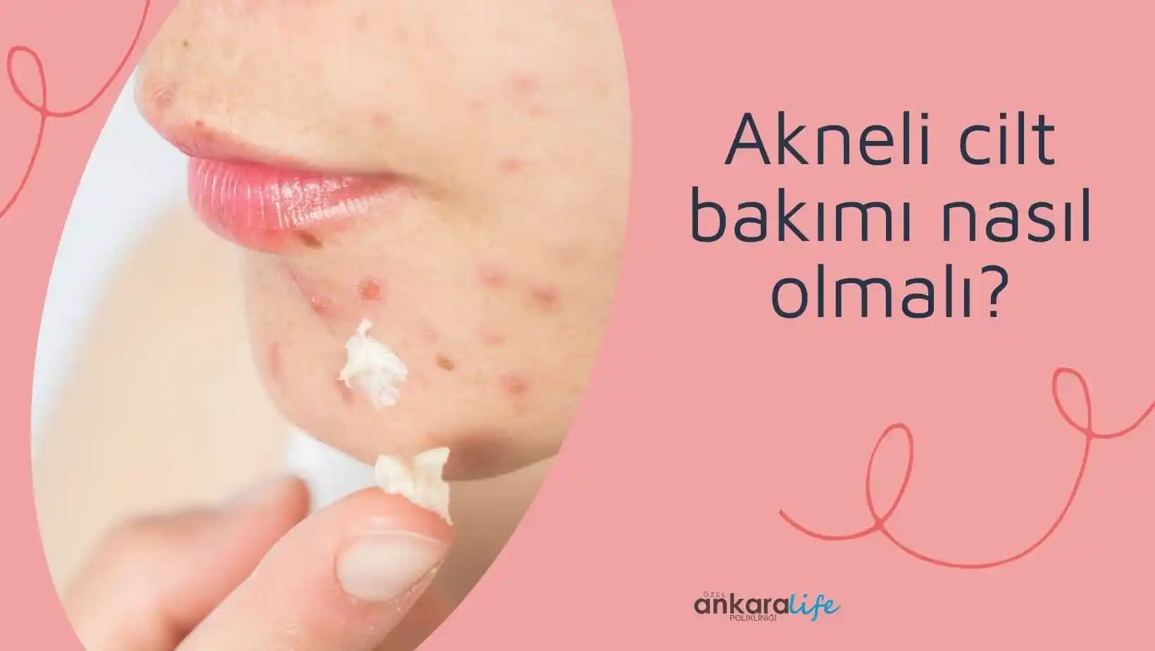 Akne Eğilimli Ciltler İçin Etkili ve Güvenilir Bakım Yöntemleri Rehberi