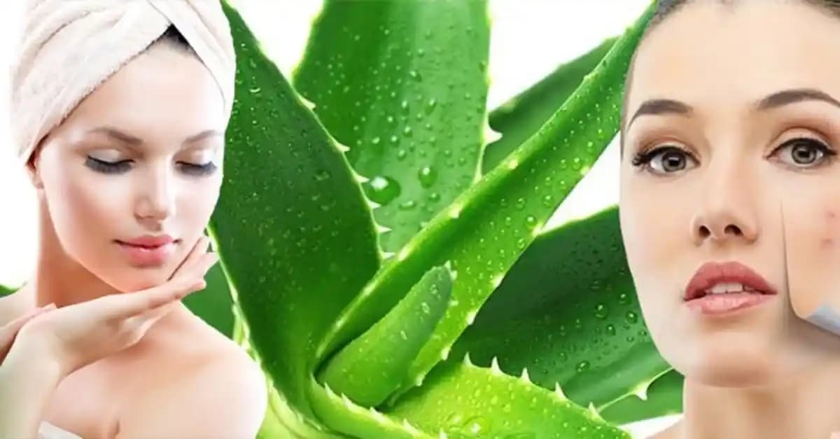 Aloe Vera ve Sivilce: Doğal Çözüm Olarak Etkileri ve Kullanım Yöntemleri