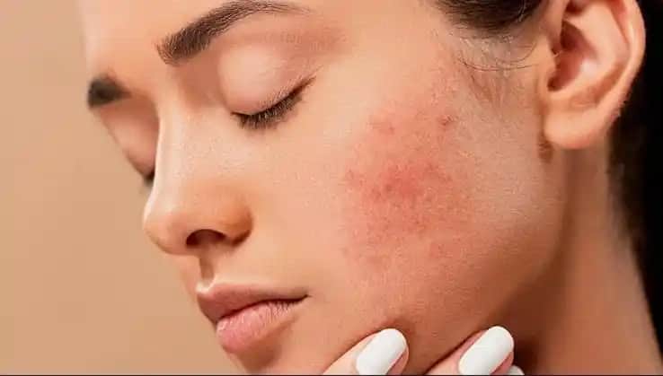 Atopik Ciltler İçin Günlük Bakım ve Etkili Öneriler