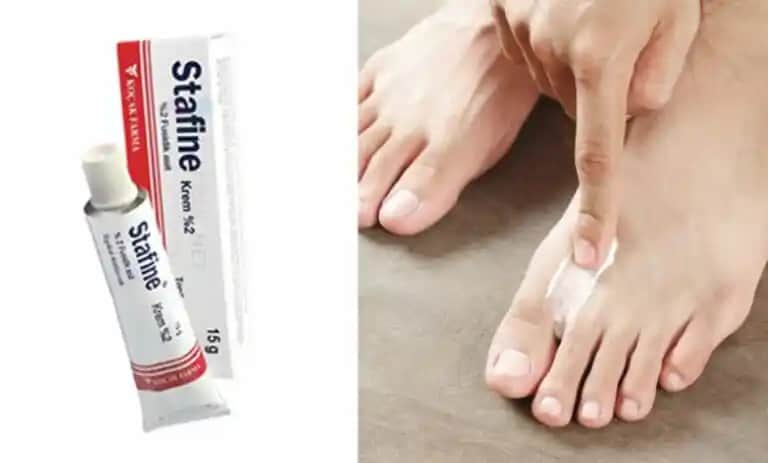 Ayak Yaraları İçin En Etkili Kremler ve Bakım Yöntemleri Hakkında Bilgi