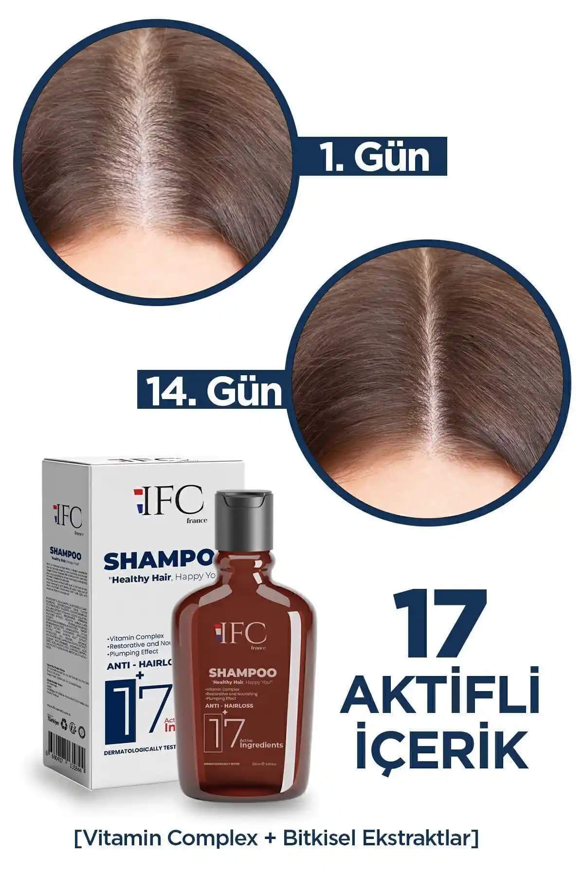 Bebeklerde Saç Uzatan Güvenli ve Etkili Şampuan Seçenekleri ve Bakım İpuçları