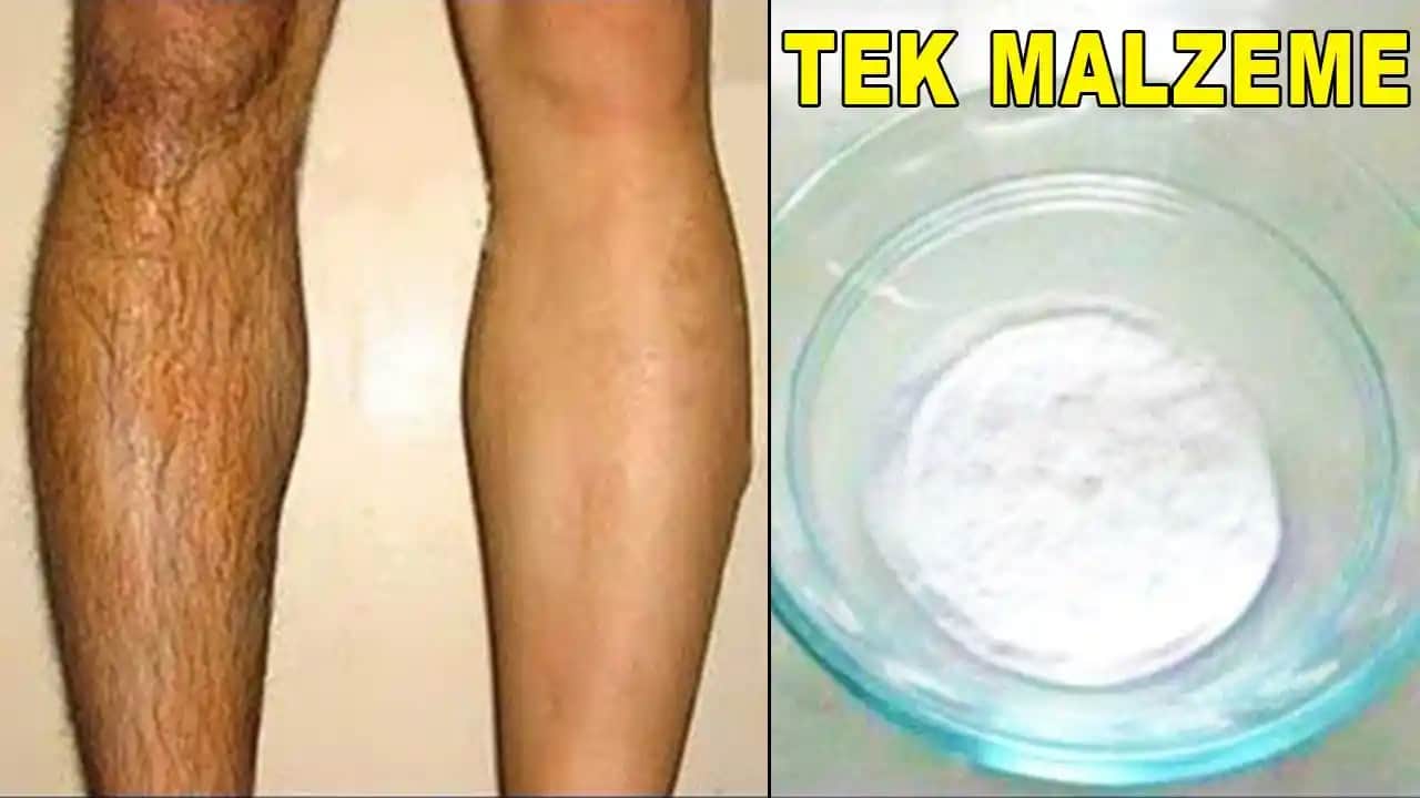 Üç Kullanımda Tüyleri Yok Eden Güvenilir ve Etkili Kremler Rehberi