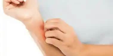 Apış Arası Kokusu ve Çözüm Yolları: Günlük Bakımda Dikkat Edilmesi Gerekenler