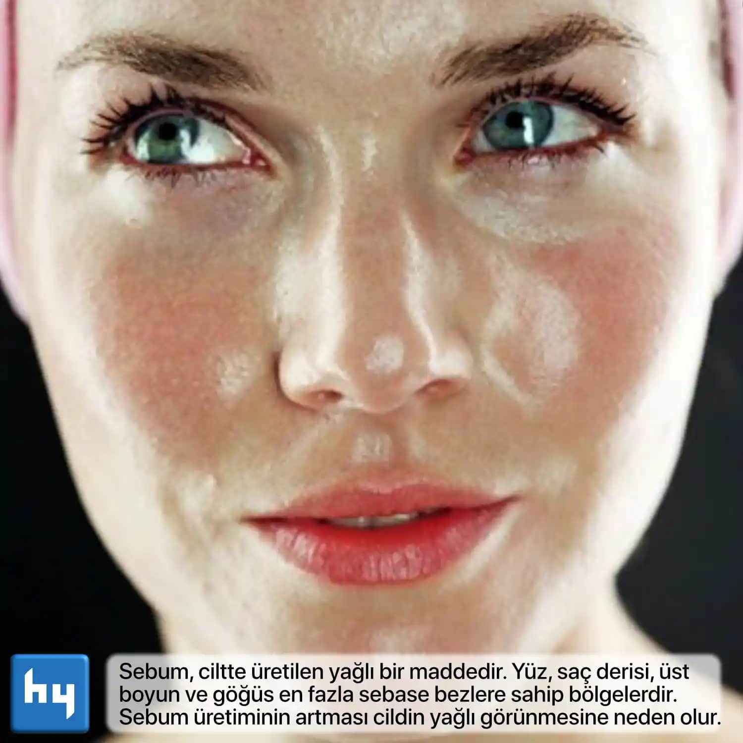 Aşırı Yağlı Yüz Problemi ve Etkili Bakım Yöntemleri Hakkında Kapsamlı Rehber