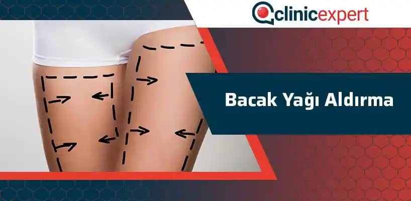 Bacak Yağı Nedir, Neden Oluşur ve Etkili Mücadele Yöntemleri Nelerdir