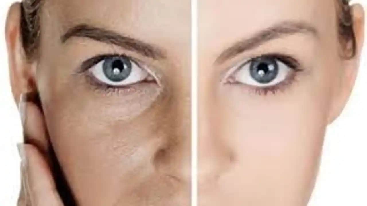 Burun Gözenekleri Temizliği ve Bakımı İçin Uzman Tavsiyeleri ve Etkili Yöntemler