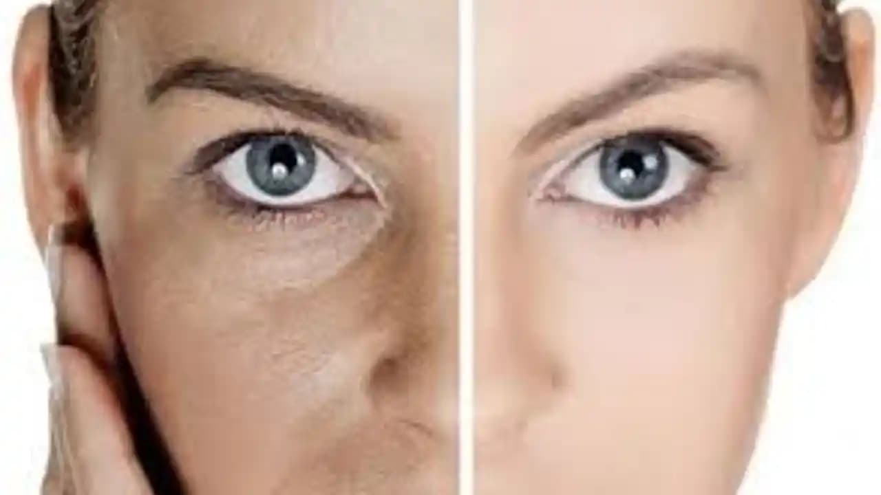 2025'te Burun Gözeneklerinizi Sıkılaştırmanın 5 Şaşırtıcı Yolu