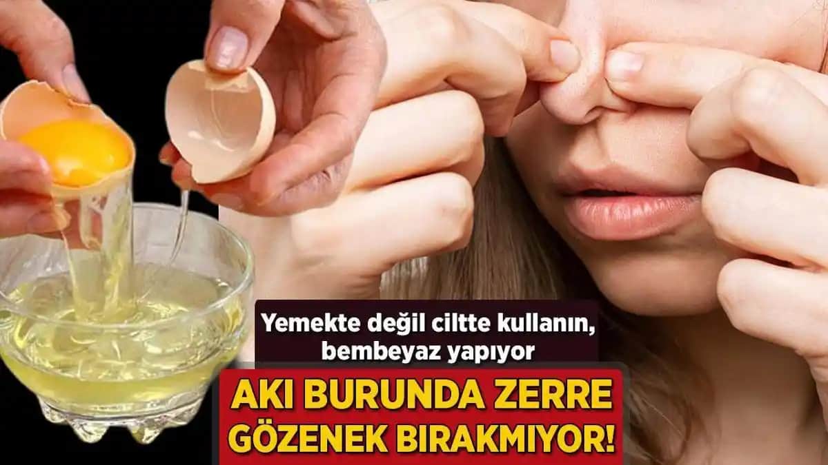 Burunda Gözenekleri Azaltma ve Sağlıklı Tutma Yöntemleri Rehberi