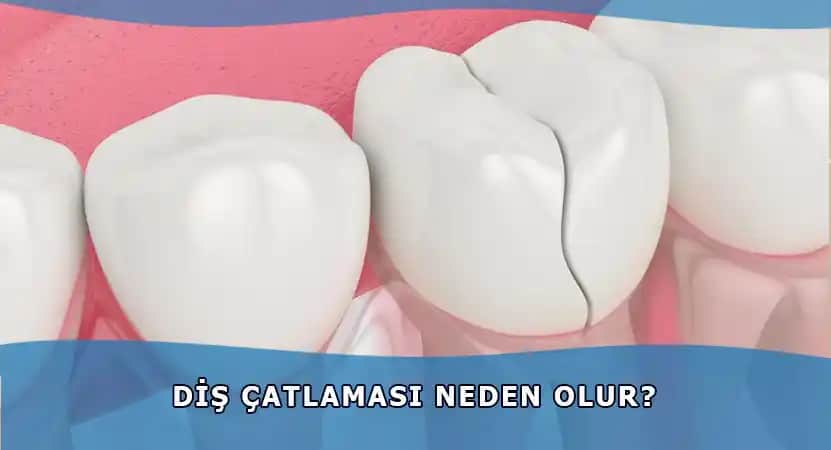 Ciltte Çatlaklar Nasıl Oluşur ve Etkili Önleme Yöntemleri Nelerdir
