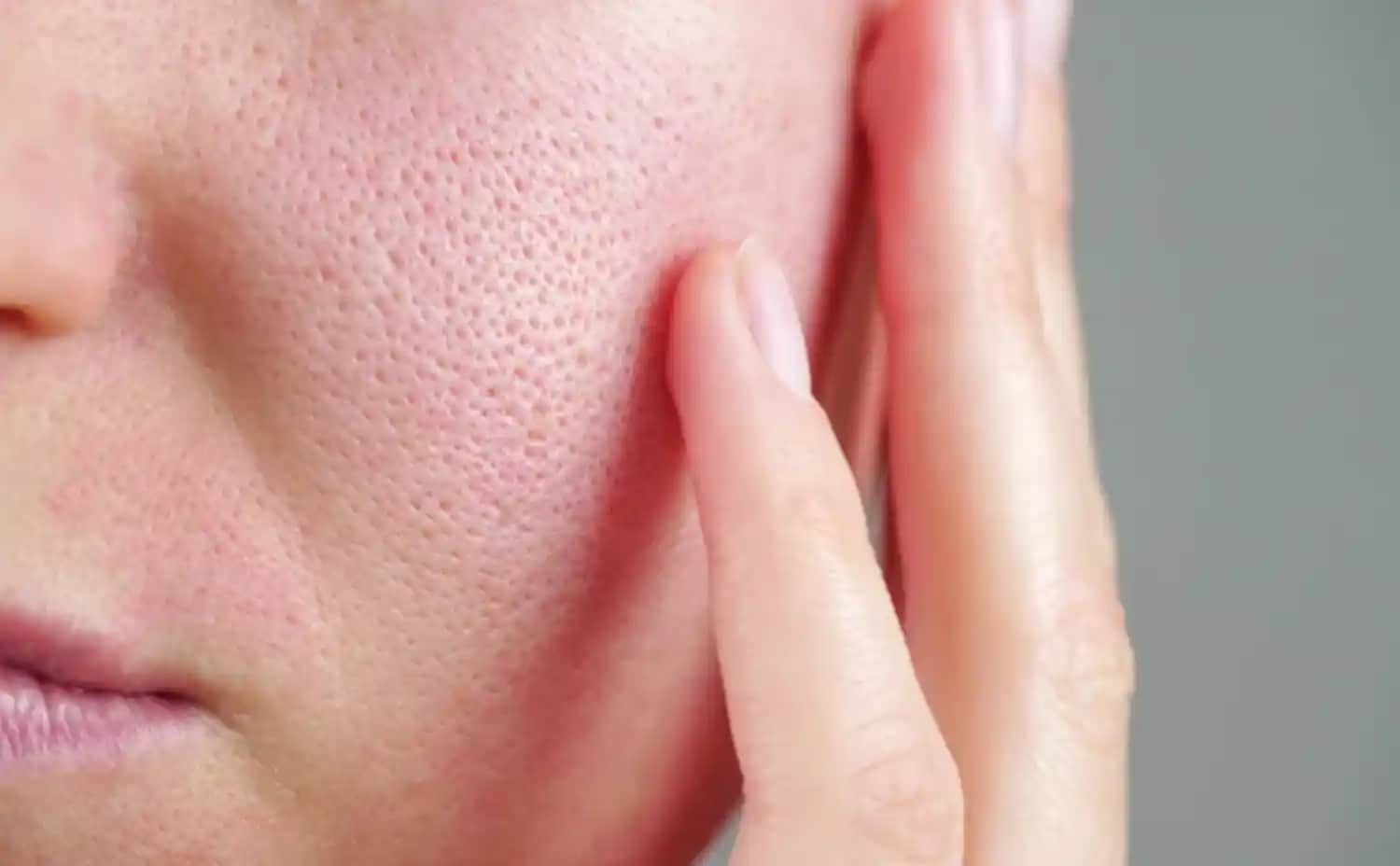 Ciltte Gözeneklerin Sağlıklı ve Pürüzsüz Görünümünü Koruma Yöntemleri ve Bakım İpuçları