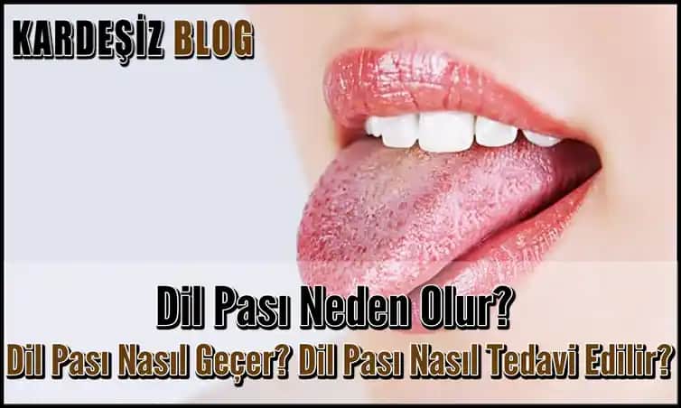 Dil Pası Nedir, Nasıl Önlenir ve Ağız Sağlığını Koruma Yöntemleri
