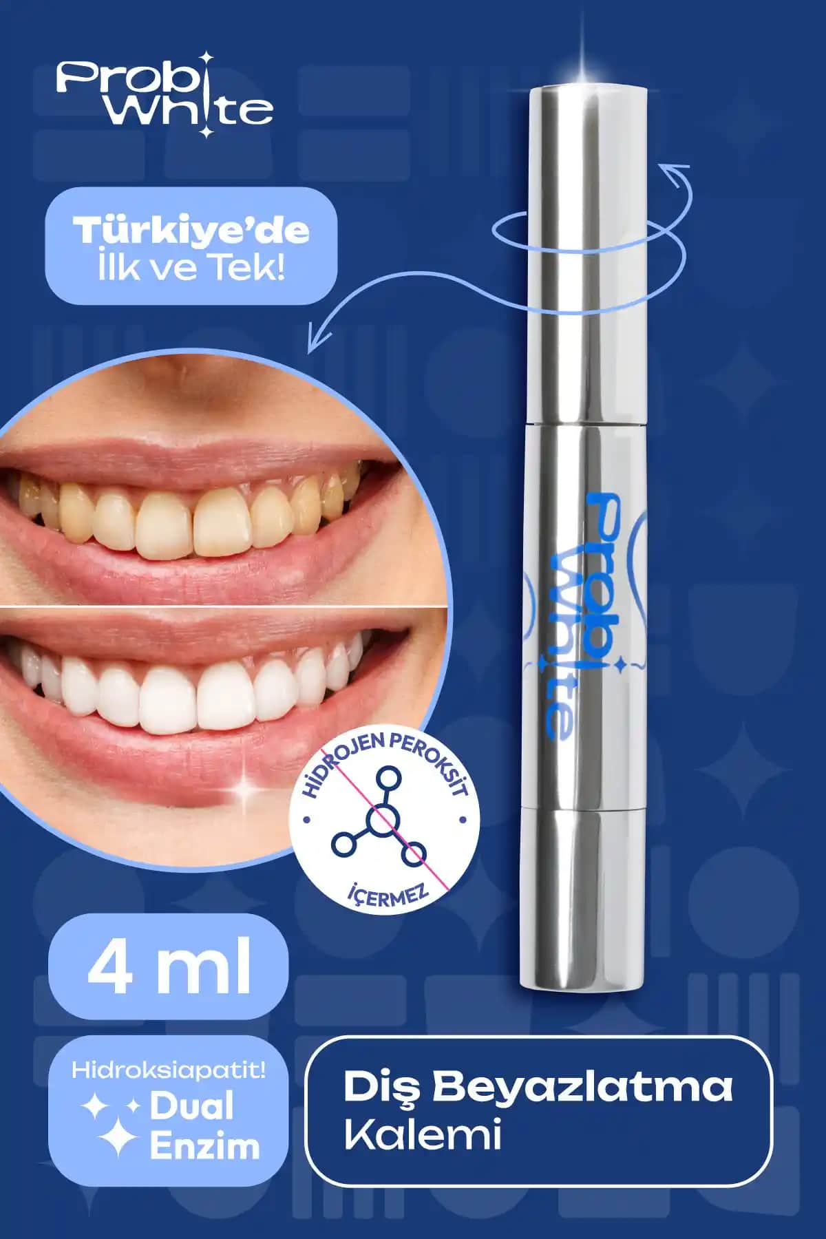 Diş Beyazlatma Kalemi Nedir ve Gülüşünüzü Parlatmak İçin Nasıl Kullanılır