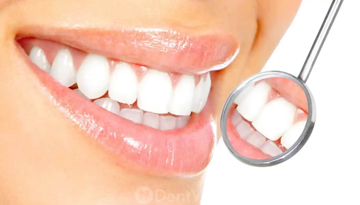 Diş Beyazlatma Yöntemleri ve Güvenli Uygulama Seçenekleri Hakkında Bilgiler