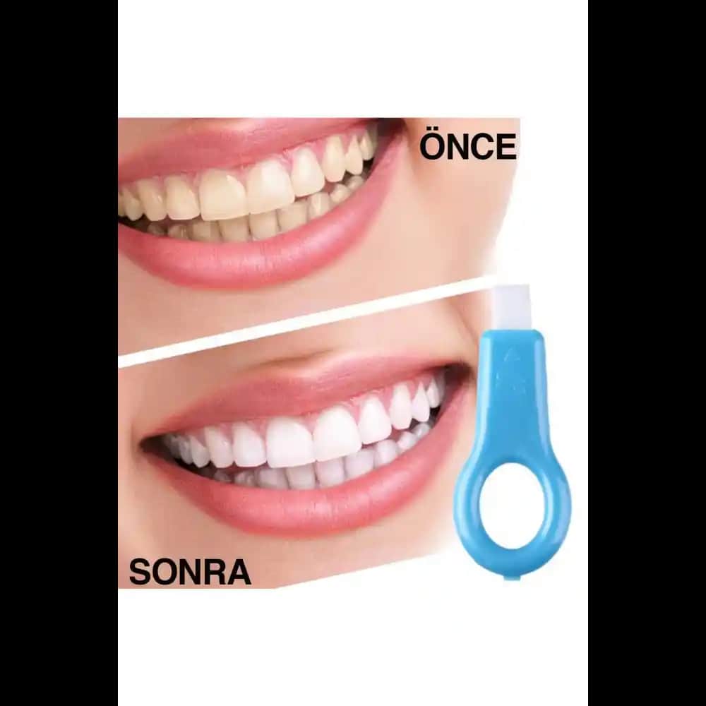 Diş Lekelerini Gidermenin En Etkili Yöntemleri ve Parlak Gülüşler İçin Tavsiyeler