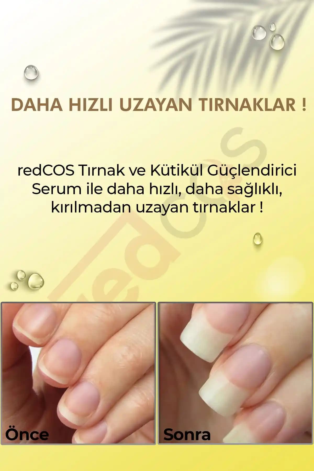 Eczanede Satılan Tırnak Güçlendirici Ürünler: Sağlıklı ve Güçlü Tırnaklar İçin Rehber