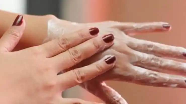 El Çatlaması Nasıl Geçer? Kozmetik ve Kişisel Bakımda Etkili Çözüm Yöntemleri