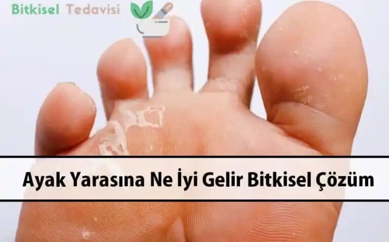 El Yaralarına İyi Gelen Doğal ve Kozmetik Çözümlerle Hızlı İyileşme Yöntemleri