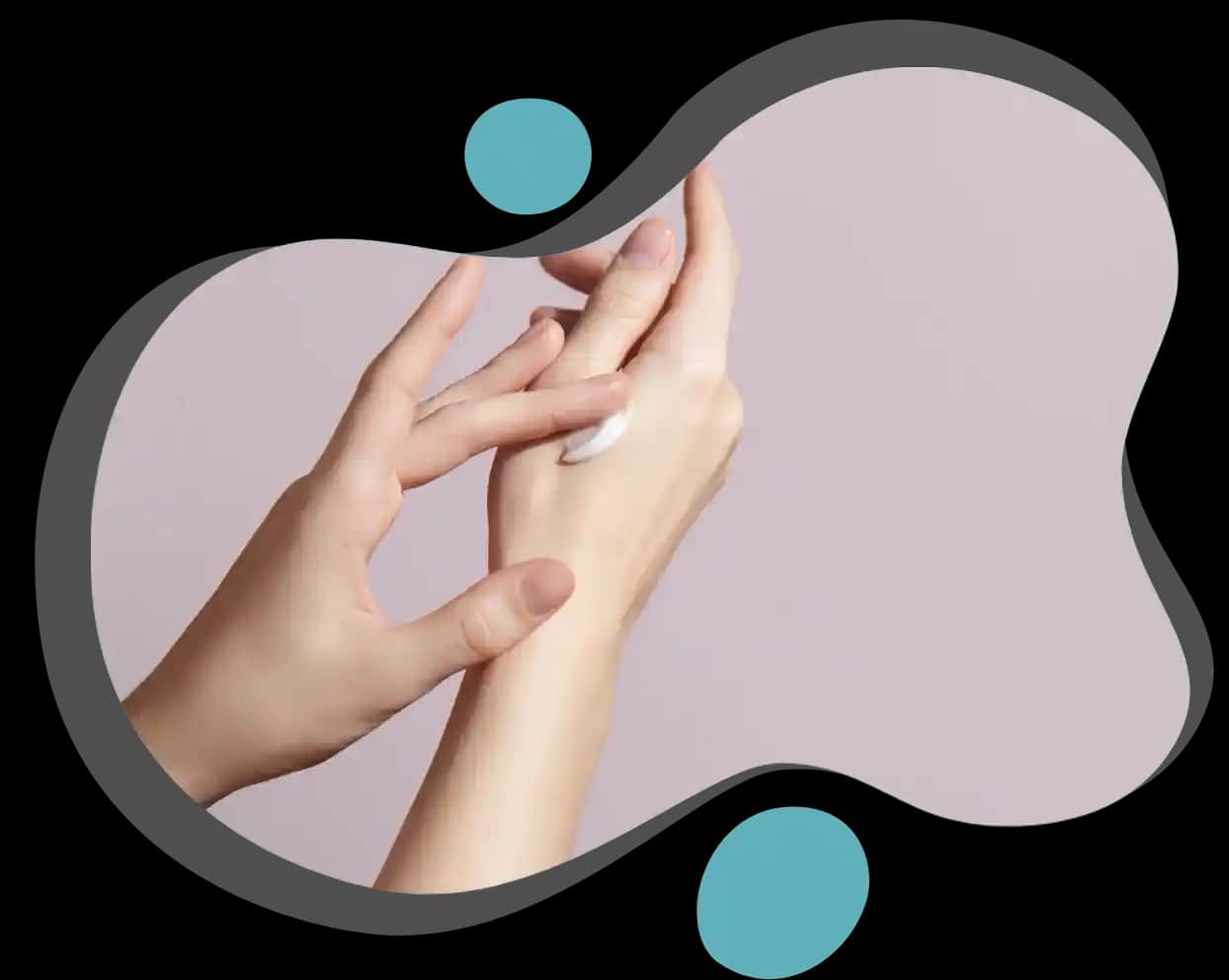 Elde Çatlaklarına Karşı Etkili ve Doğal Bakım Yöntemleri Nelerdir