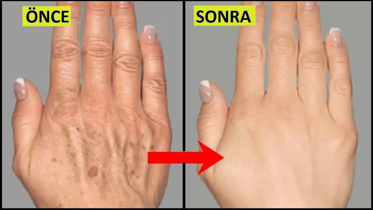 Elde Çıkan Lekelerin Nedenleri ve Etkili Giderme Yöntemleri Hakkında Detaylı Bilgi