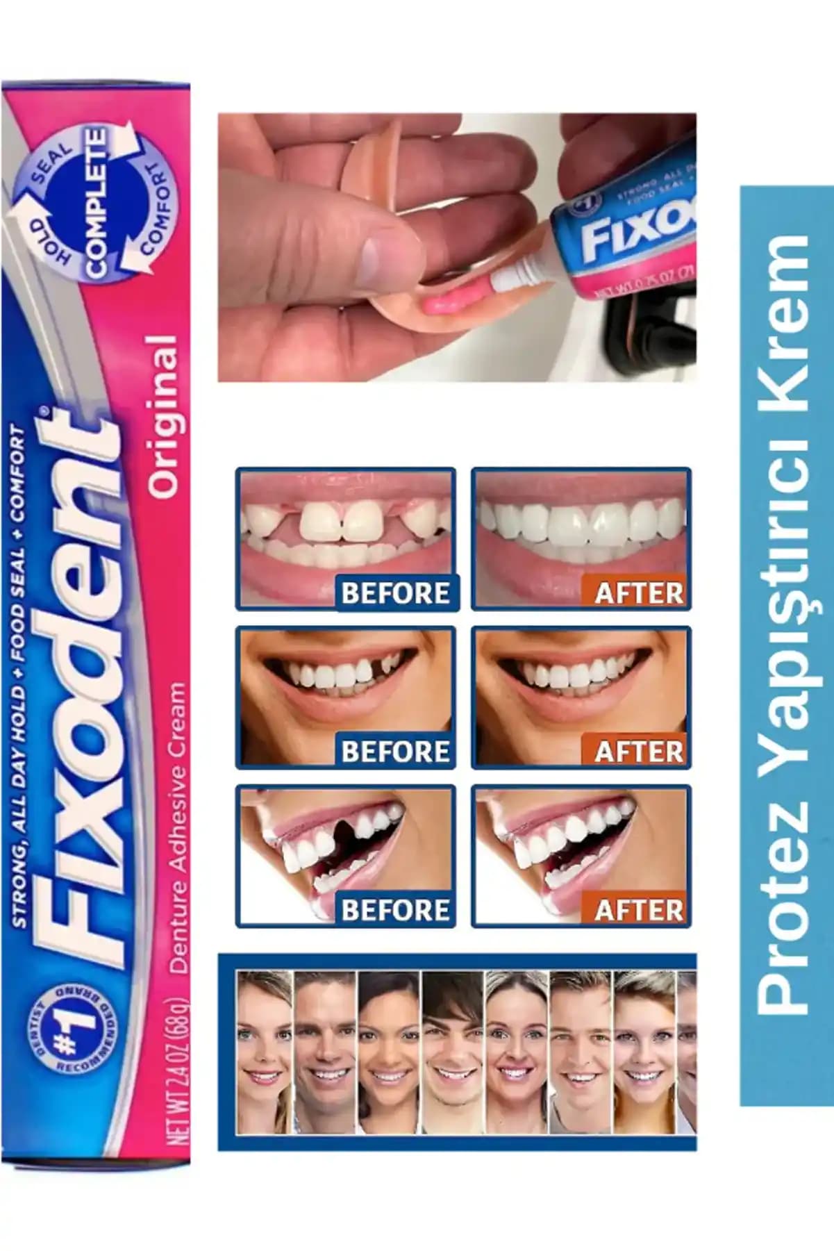 Fixodent Diş Yapıştırıcısı: Güvenli ve Konforlu Protez Kullanımı İçin Rehber