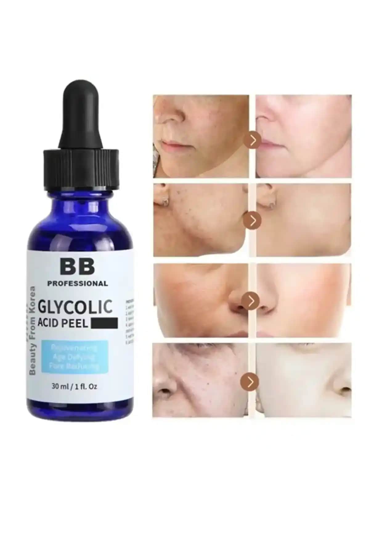 Glikolik Asit Peeling Nedir, Nasıl Uygulanır ve Cilt Faydaları Nelerdir