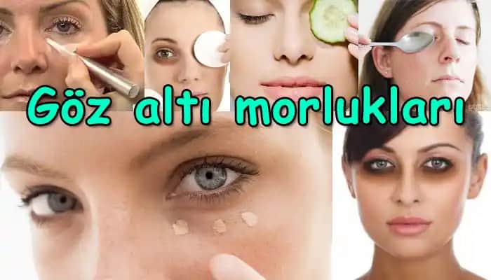 Göz Altı Kırışıklarını Giderme Yöntemleri ve Cilt Sağlığı İpuçları