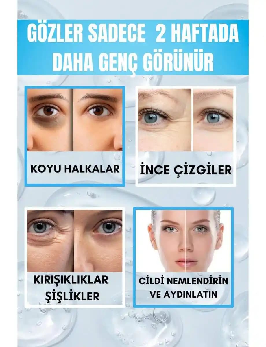 Göz Altı Kırışıklıklarına Karşı Etkili Önlemler ve Modern Tedavi Yöntemleri