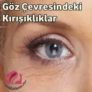 Göz Çevresi Kırışıklıkları Nedenleri, Belirtileri ve Etkili Bakım Yöntemleri