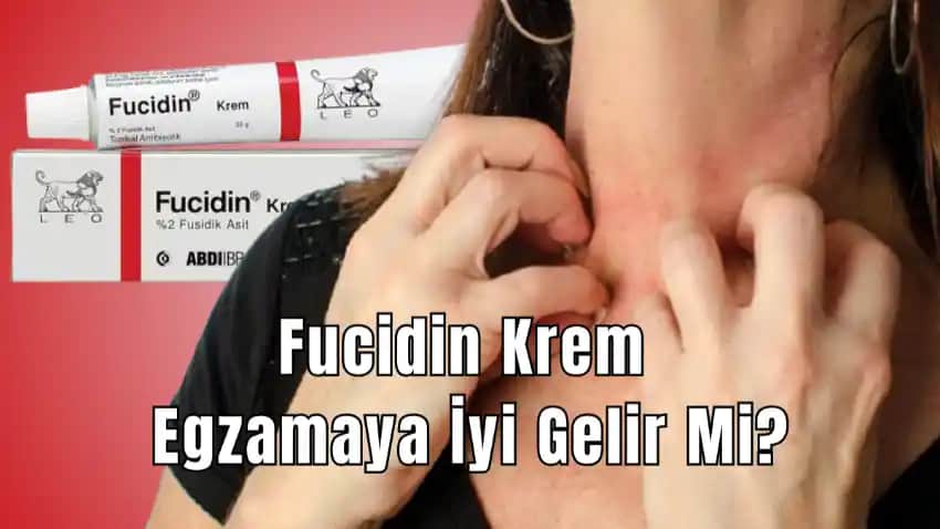 Gözdeki Egzama İçin Güvenilir ve Etkili Krem Seçenekleri Rehberi