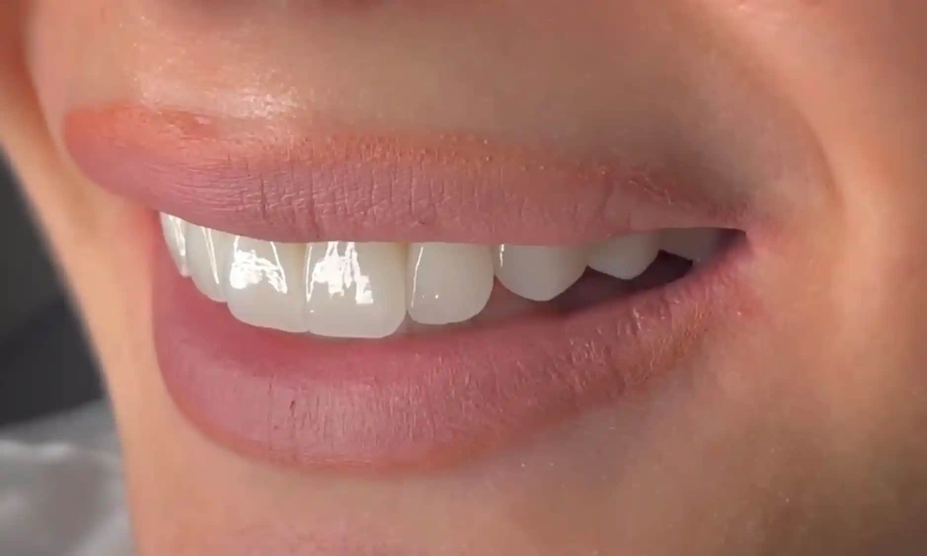 Güzel Dişler İçin Sağlıklı ve Estetik Gülüş Yaratma Yöntemleri