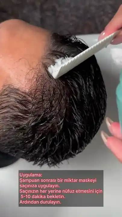 Kepekli Saçlar İçin Etkili Çözüm Yöntemleri ve Doğal Bakım İpuçları