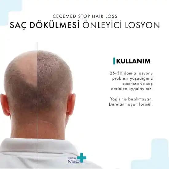 Saç Dökülmesine Karşı Etkili Çözüm: CeceMed Losyonu ile Sağlıklı ve Güçlü Saçlar