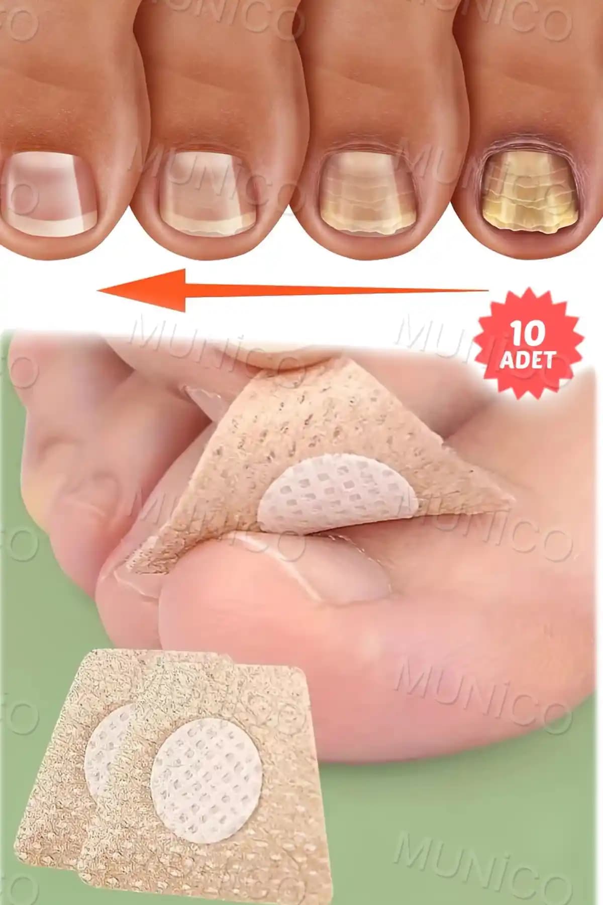 Munico 10 Çift Mantar Tırnak Yaması: Ayak ve El Tırnaklarında Güçlü Tedavi ve Yenilenme