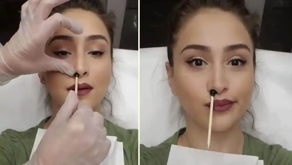 Burun Ağdası Nedir ve Güvenli Kullanım Yöntemleriyle Estetik Çözüm